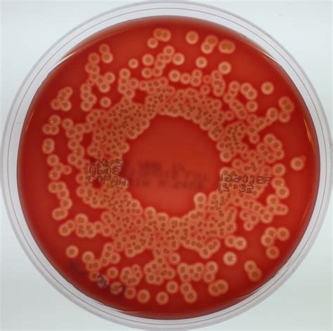 Hemolytic E. coli on blood agar | This E. coli strain was pl… | Flickr