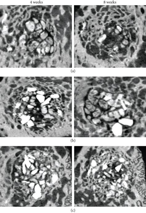 Micro-CT bone volume samples. 3D area of new bone volume formation... | Download Scientific Diagram