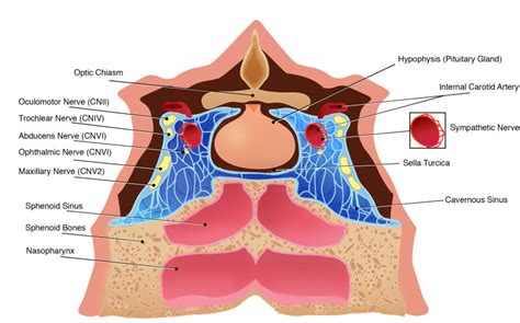 [Figure, Cavernous Sinus Anatomy Cavernous Sinus...] - StatPearls ...