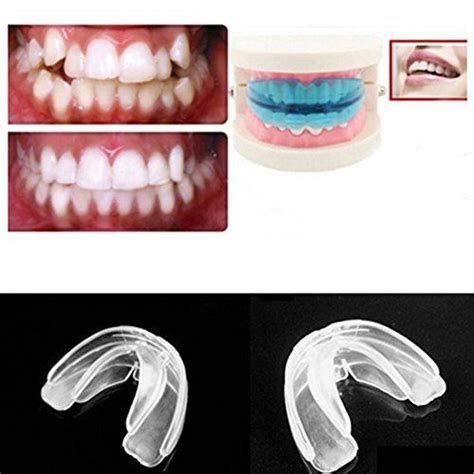 diy teeth straightening kit - Good Inside Forum Slideshow