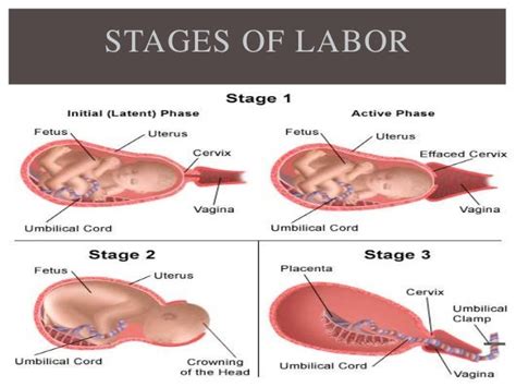 First Stage of Labour and Midwifery Care