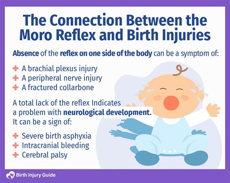 Are Birth Asphyxia and Moro Reflex Related? - Birth Injury Guide