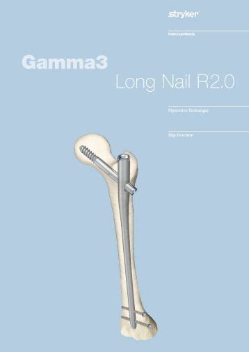 Gamma Nail Operative Technique – Nail Ftempo