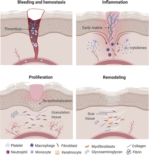 | Wound healing process. Once the wound is formed, inflammatory cells ...