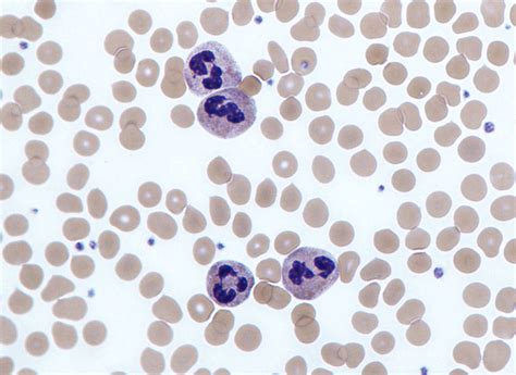 Neutrophil - Wikipedia