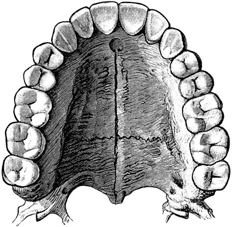 56677_teeth_lg.gif (1024×1002) Dentistry Student, Dental Student, Medical Dental, Dental Hygiene ...