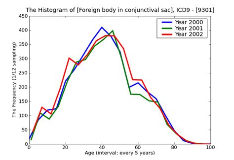 histogram of Disease Foreign body in conjunctival sac ICD9 -Foreign body in conjunctival sac