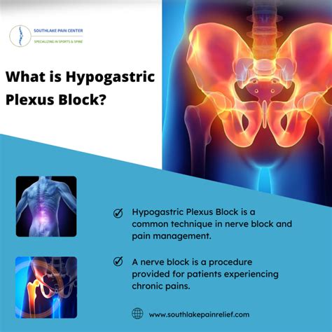 Hypogastric Plexus Block – South Lake Pain Center – Pain Management ...