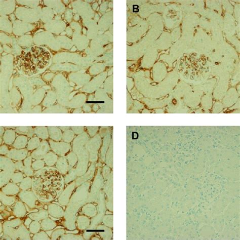 Immunohistochemistry for thrombomodulin (bar 50 m). Thrombomodulin ...