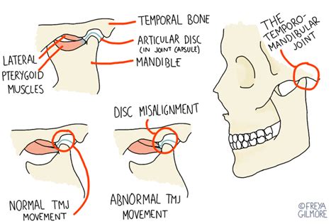 The TMJ: jaw pain and clicking - Gemini Osteopathy