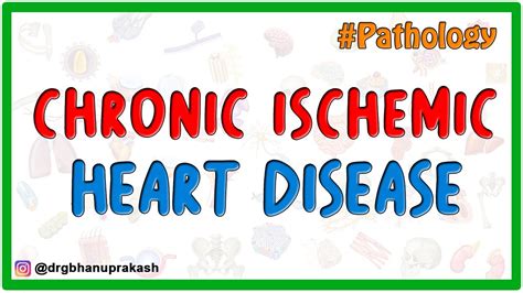 Chronic Ischemic Heart Disease - Pathology USMLE Step 1 - YouTube