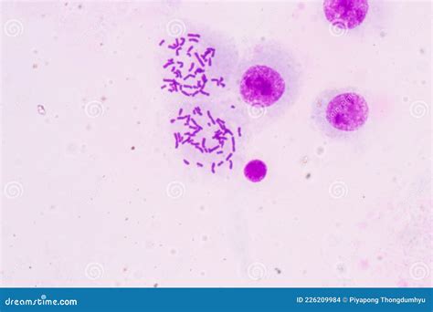 Chromosomes Human Under the Microscope. Stock Photo - Image of genetic ...