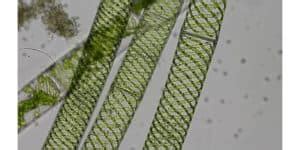 What is Spirogyra? (Characteristics, Classification, and Structure) – Microscope Clarity