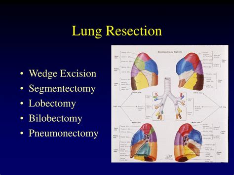 PPT - Common Thoracic Procedures PowerPoint Presentation - ID:520658