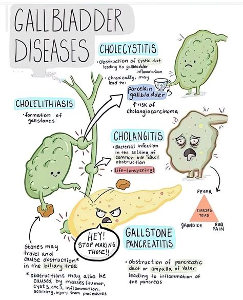 Gallbladder Diseases Chart - Phartoonz