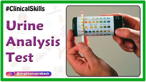 Urine analysis test procedure : Biochemistry Practicals - YouTube