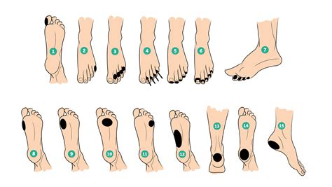 The Complete Guide to Foot Blister Management for Hikers, Walkers and ...