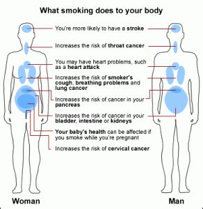 Smokers Cough - Definition, Symptoms, Treatment and Remedies