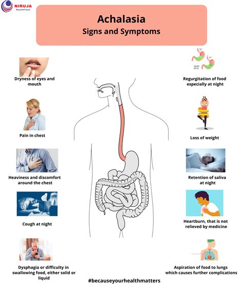 Achalasia: Signs & Symptoms | Signs and symptoms, Symptoms, Signs