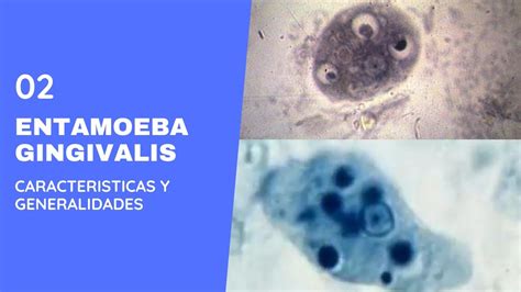 Entamoeba gingivalis 2.0 ||Parasitología || Amebas || Amebiasis intestinal - YouTube