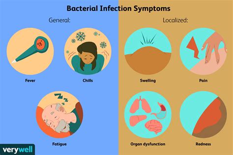 How To Avoid A Bacterial Infection - Documentride5