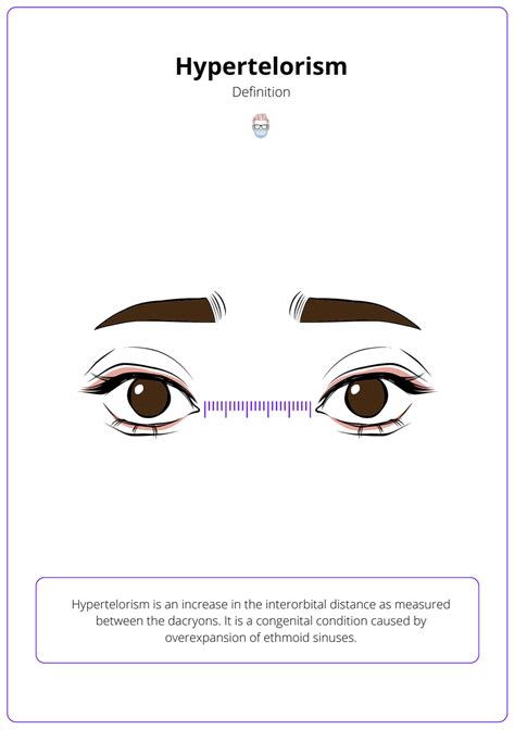 Hypertelorism: Definition, Classifying, Causes, & Treatment