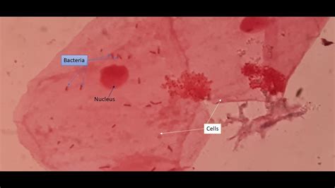 Cheek Epithelial Cells Bacteria