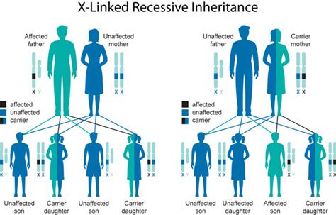 Chronic granulomatous disease causes, symptoms, diagnosis & treatment