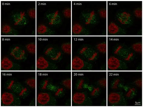 Live-Cell Imaging: Choosing The Right Technique