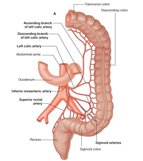 inferior mesenteric artery cwargubuh: inferior mesenteric artery | School | Pinterest