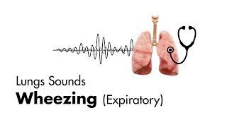 Wheezing (expiratory) - Lung Sounds - MEDZCOOL | Doovi