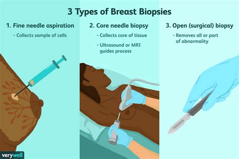 Breast Biopsy Procedure: Uses, Side Effects, Results