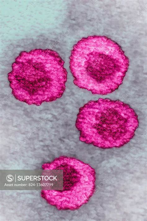 Varicella zoster virus (VZV or HHV 3). Image taken with transmission electron microscopy ...