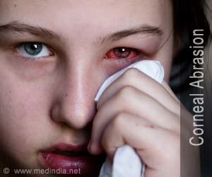 Corneal Abrasion-First Aid and Emergency Treatment Guide