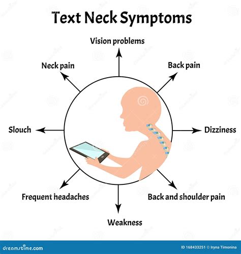 Improper Posture Symptoms. Stage Text Neck Syndrome. Spinal Curvature ...