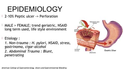 Gastric Perforation