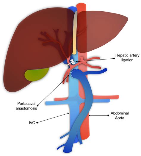 Preclinical models of acute liver failure: a comprehensive review [PeerJ]