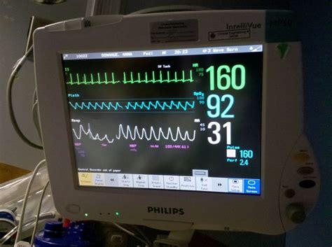 Hospital Monitor - Reference | Hospital, Monitor, Hospital photography