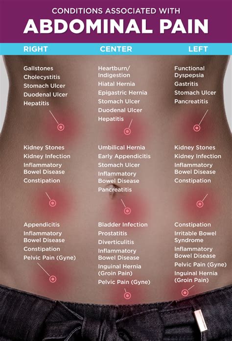 Irritable Bowel Syndrome - IBS - My Remedy Natural Medicine