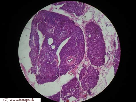 Histology Slides Database: human pancreas histology slides