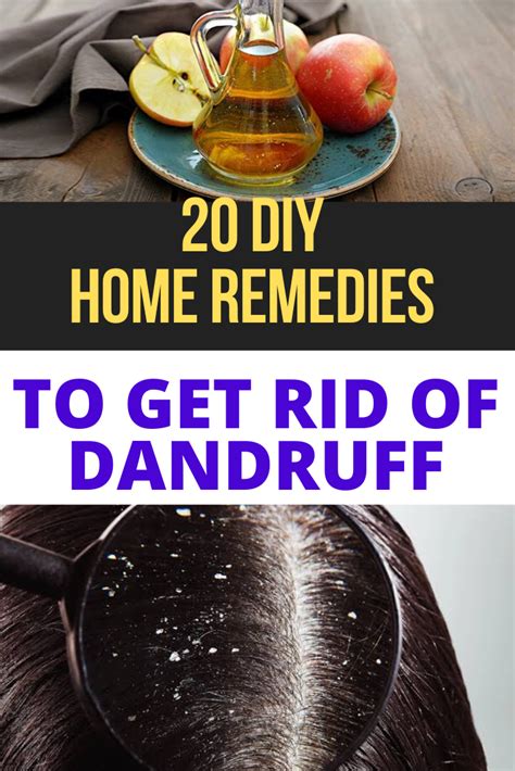 How To Get Rid Of Dandruff Naturally Permanently At Home | Trabeauli in ...