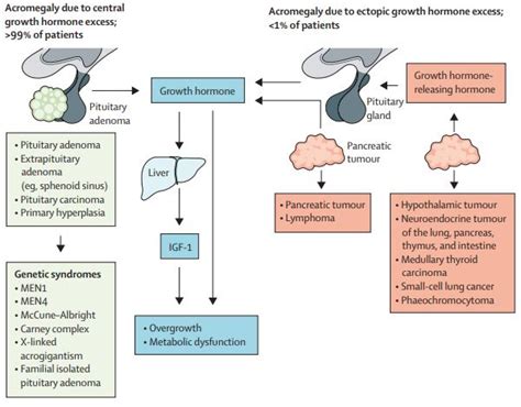 The Lancet Diabetes & Endocrinology on Twitter: "New—Acromegaly: pathogenesis, diagnosis, and ...