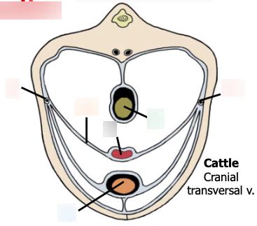 Transverse Section Organs and Ligaments Diagram | Quizlet