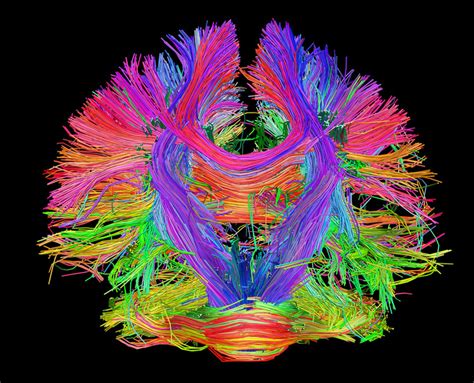 Project AGI: Thalamocortical architecture