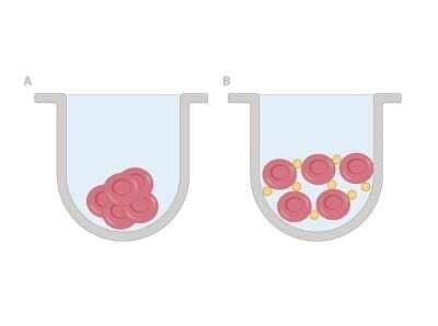 Sheep Hemagglutination Assay Kit (NBP3-05281): Novus Biologicals