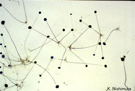 Rhizopus oryzae microscopy-2