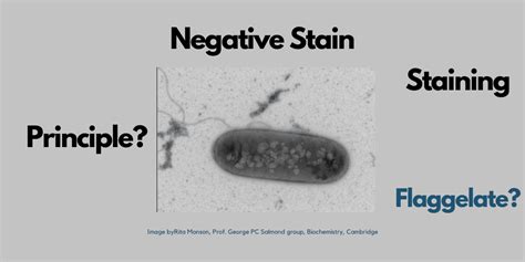 Negative staining procedure, principle, and results