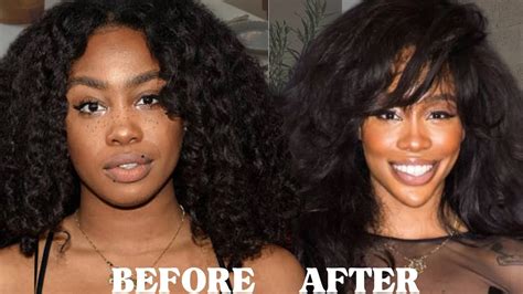 SZA Before Surgery