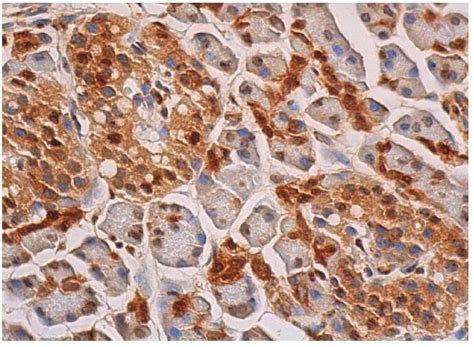 Anti-GAPDH Antibody (0411) | SCBT - Santa Cruz Biotechnology