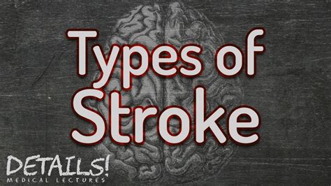 Types Of Ischaemic Stroke Oxford (Bamford) Classification, 51% OFF